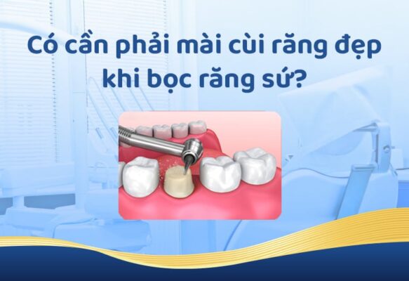 co can mai mui rang su dep khong 5