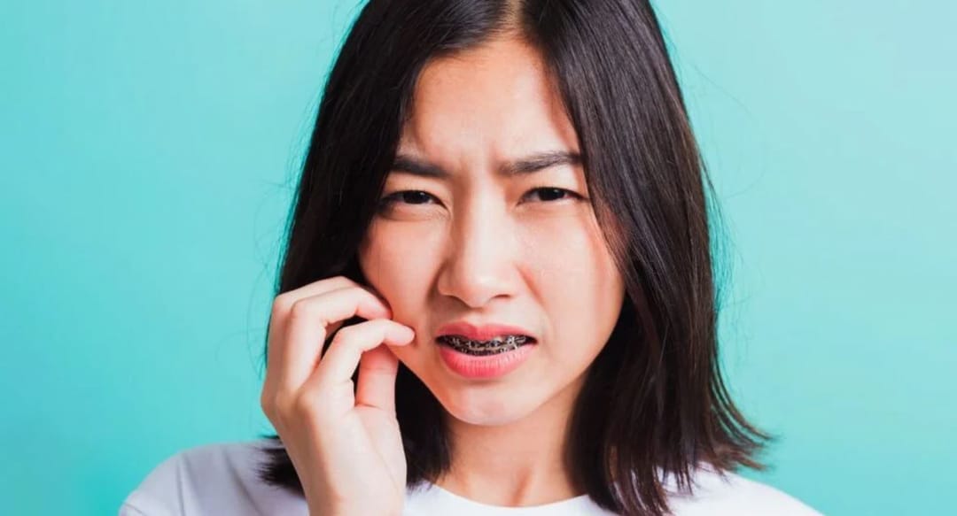 Đâu là giai đoạn xấu nhất khi niềng răng? nieng rang co dau khong 5