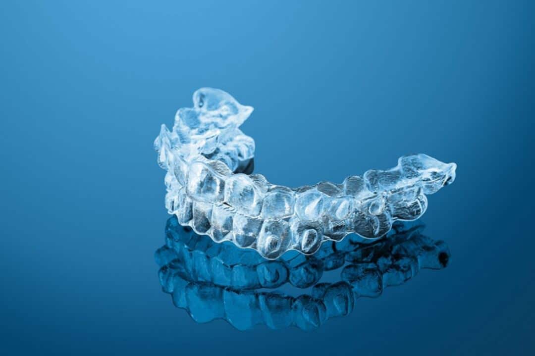 nieng trong suot Clear Aligner