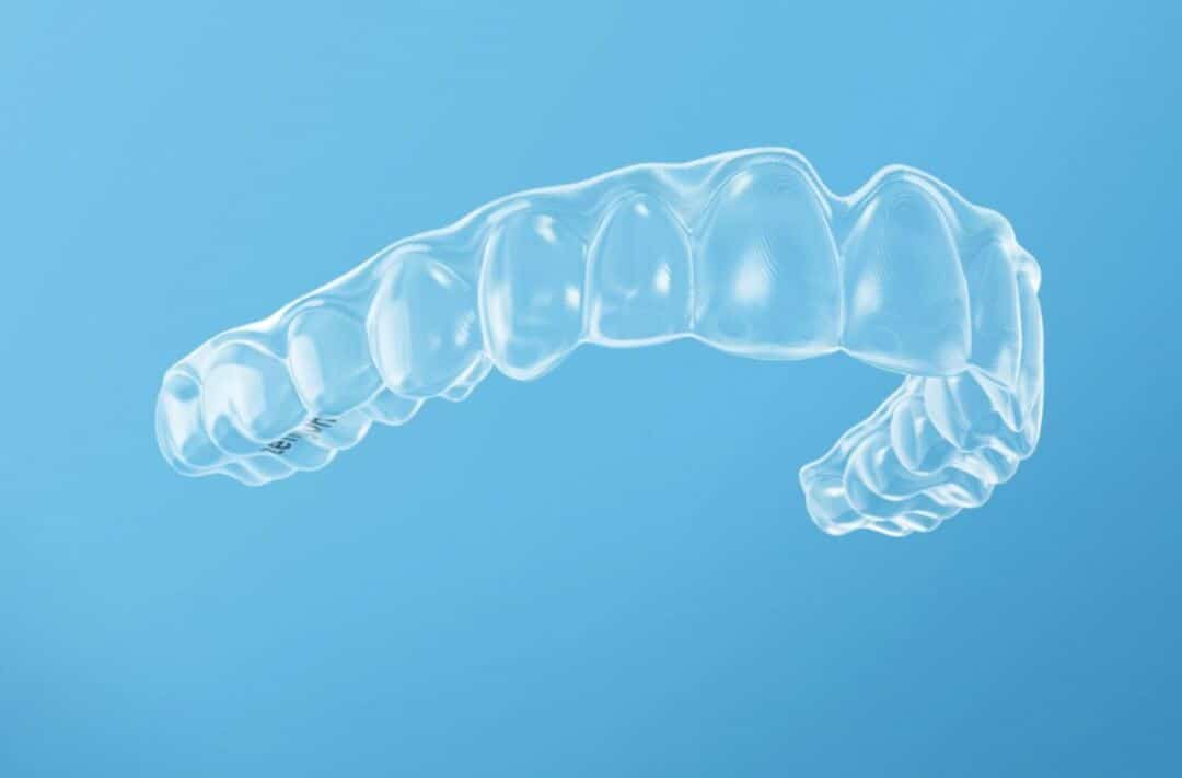 nieng rang Invisalign 
