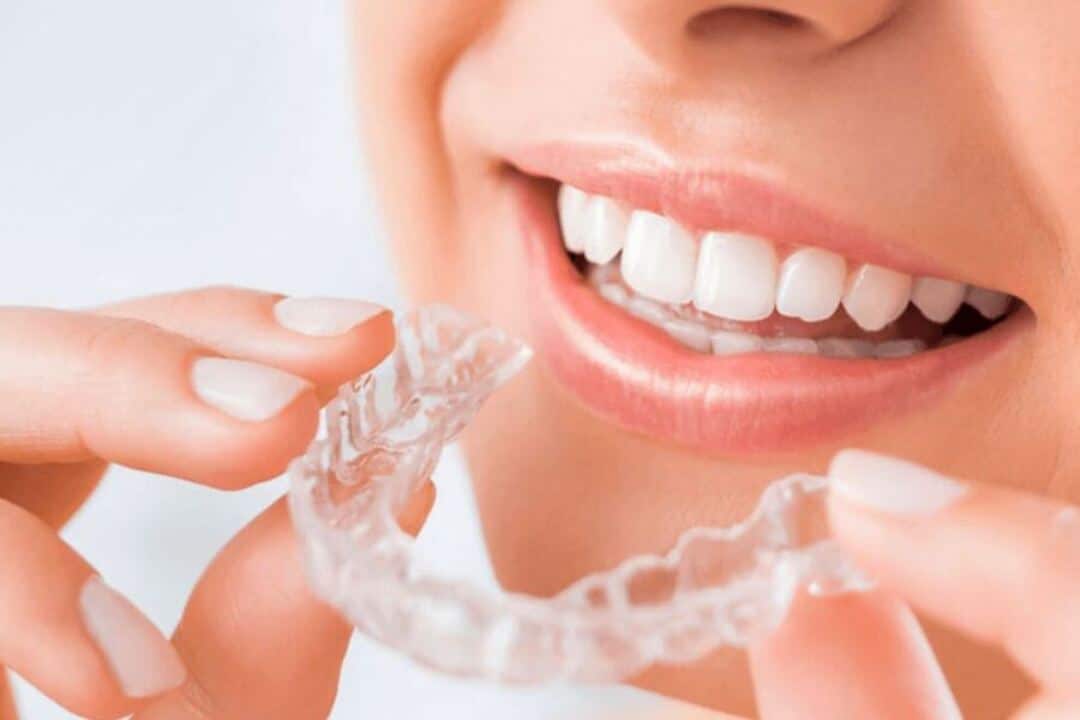 nieng rang trong suot