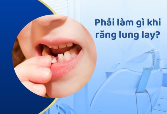 phai lamgi khi rang lung lay 5