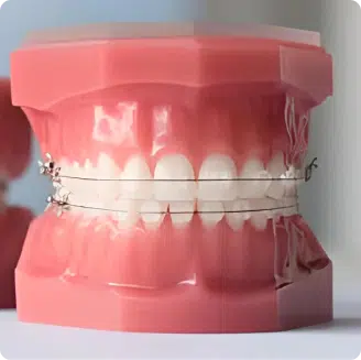 Phuong Phap Nieng Rang2 24