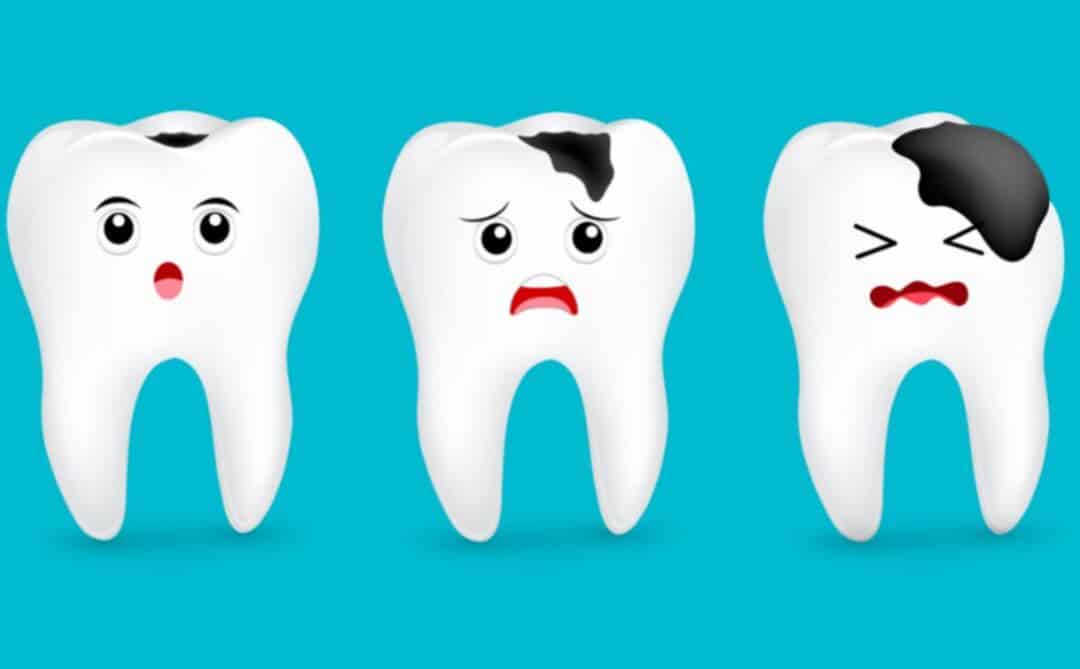 Những hậu quả của việc bọc răng sứ không an toàn rang bi sut me nen chon boc rang su 5