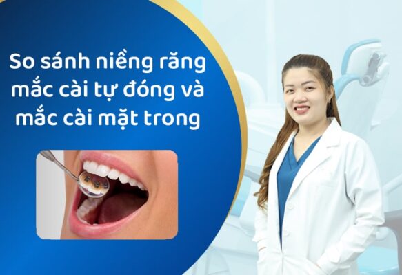 so sanh nieng rang maic cai tu dong va mac cai trong 5