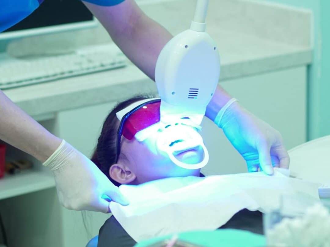 tay trang rang tai nha khoa 5s 5