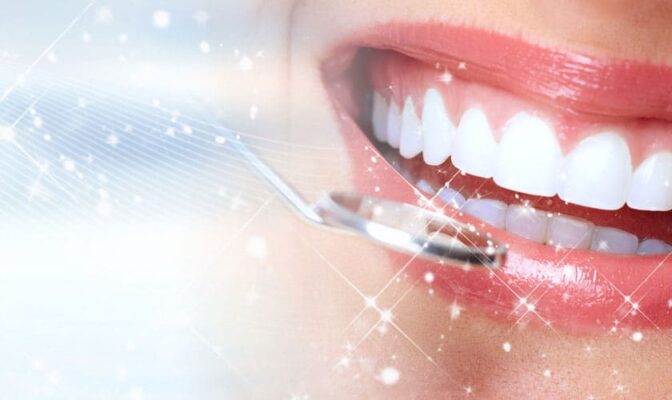 răng sứ thẩm mỹ