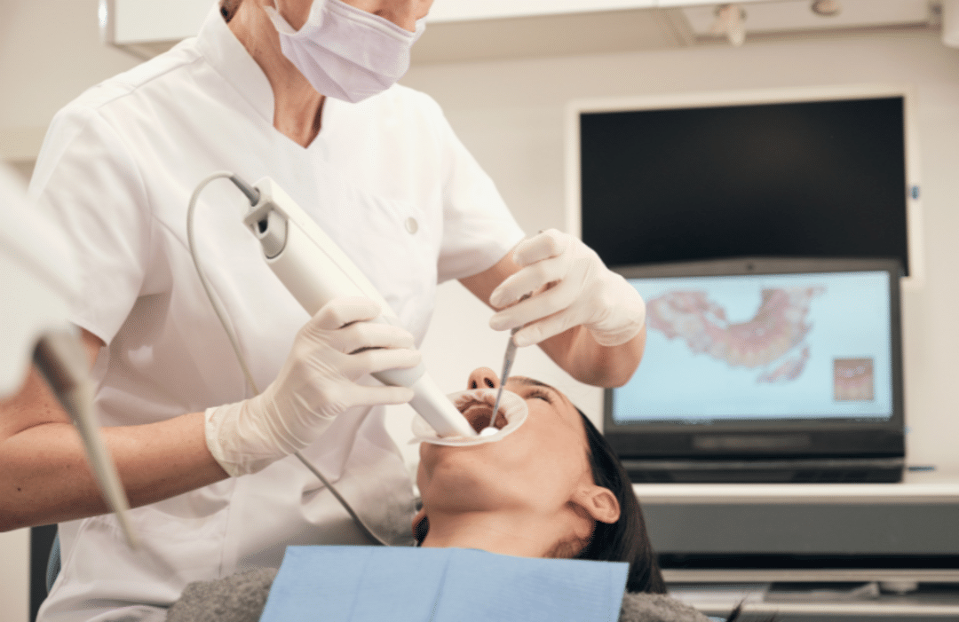 trong rang implant o dau 5