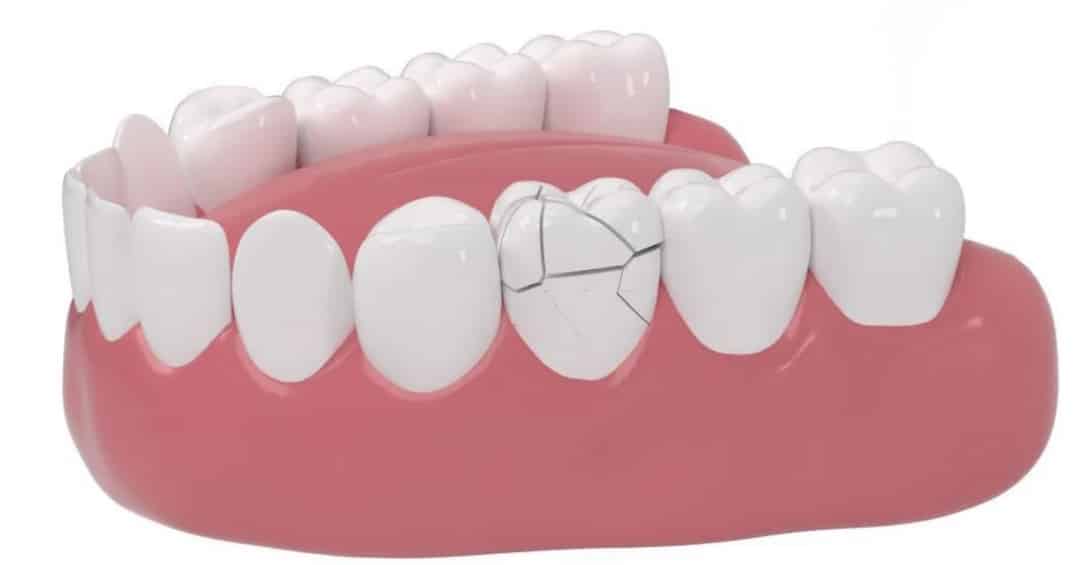 va dap manh co the khien rang sut me lung lay 5