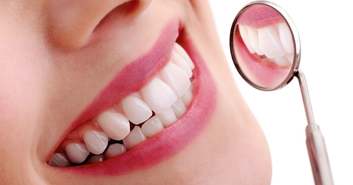 Nha khoa thẩm mỹ - Các phương pháp bạn nên biết nu cuoi dep