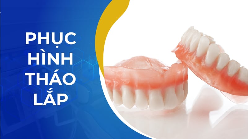 Phục hình tháo lắp