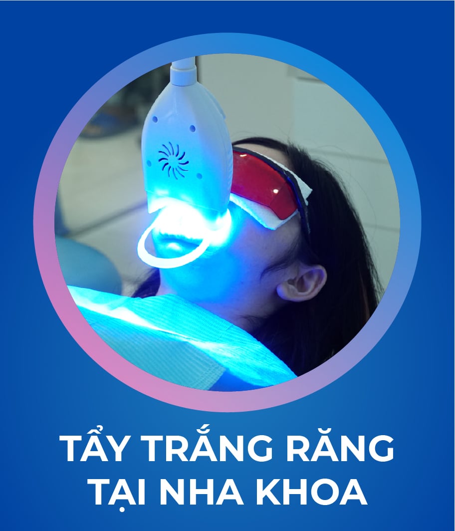 Dịch vụ Tẩy trắng răng 328 x 383_1