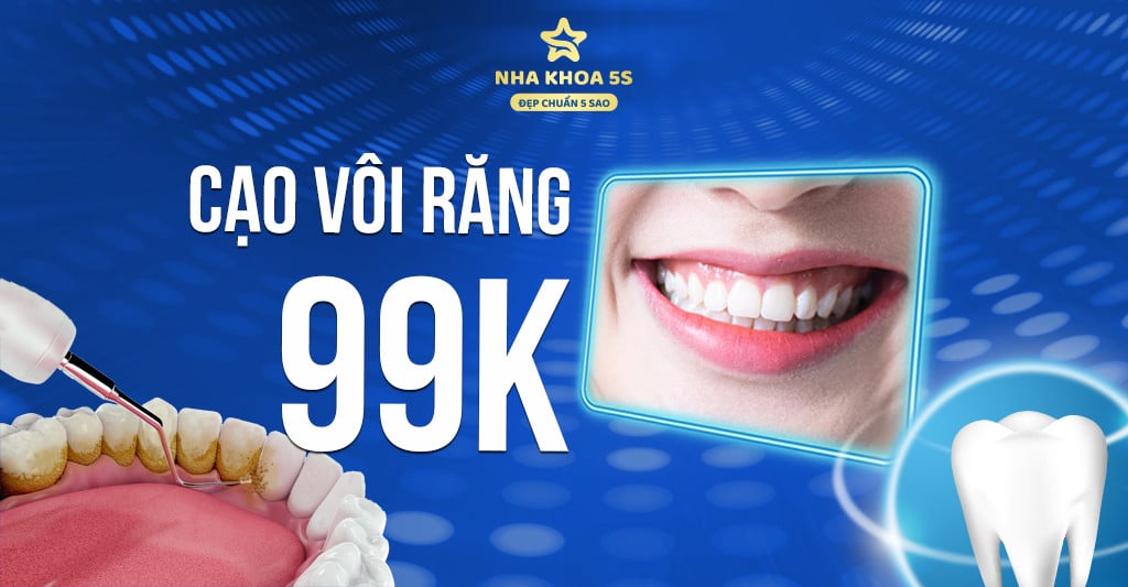 Cạo Vôi Răng 99K