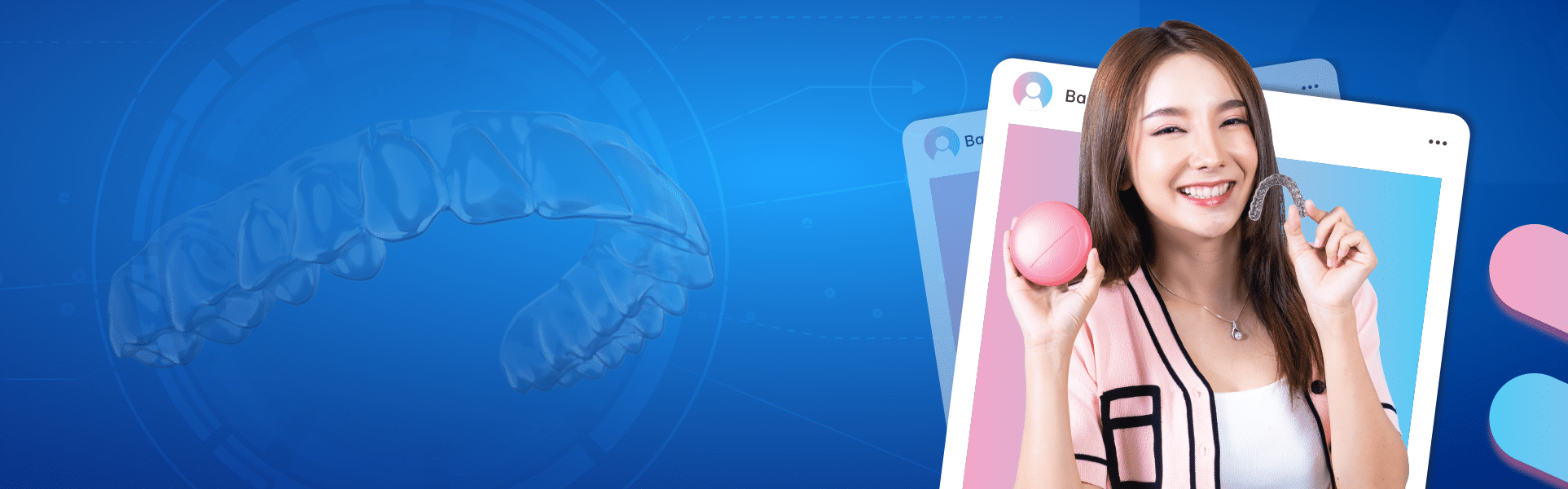 Banner niềng răng trong suốt