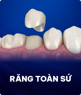 Răng Toàn Sứ