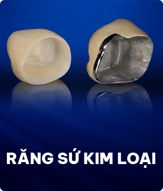 Răng sứ kim loại