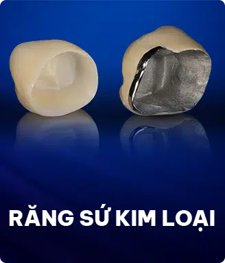Răng Sứ Kim Loại