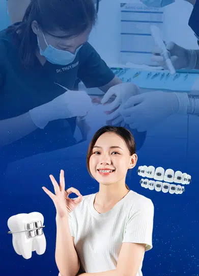 Banner Niềng Mắc Cài Mb