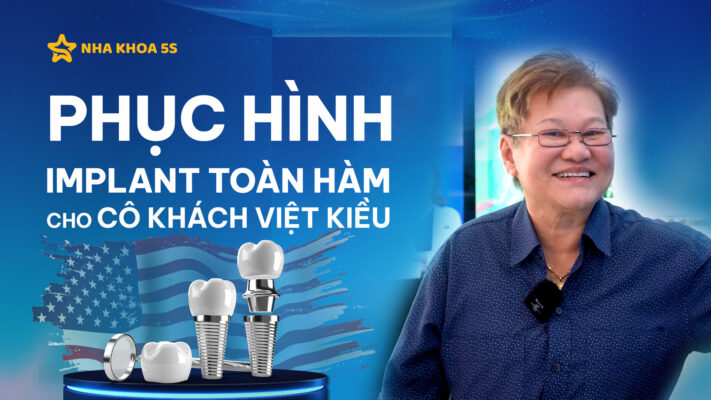 việt kiều mỹ tin tưởng trồng răng implant toàn hàm tại 5S