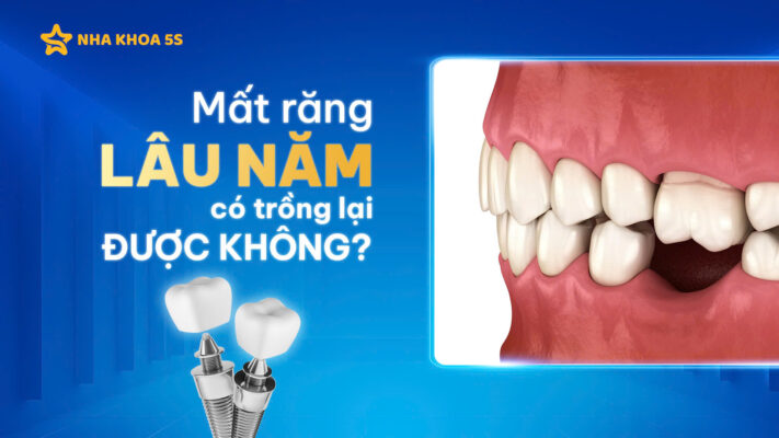 mất răng lâu năm có trồng được không