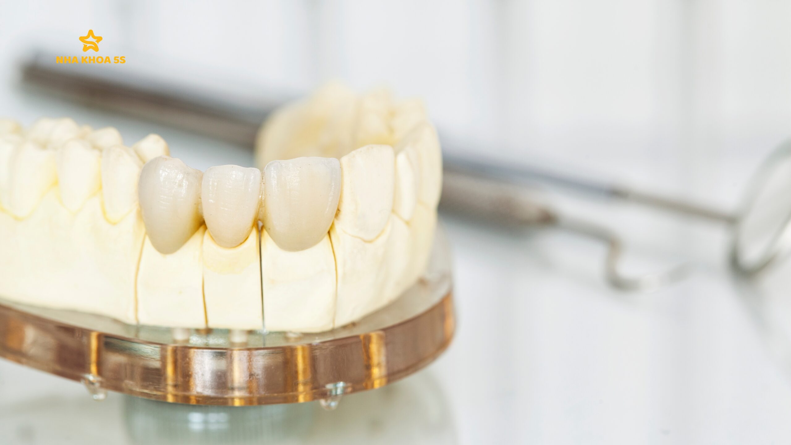 TẤT TẦN TẬT VỀ BỌC RĂNG SỨ MỸ THO: CHI PHÍ, ĐỘ BỀN, ƯU NHƯỢC ĐIỂM