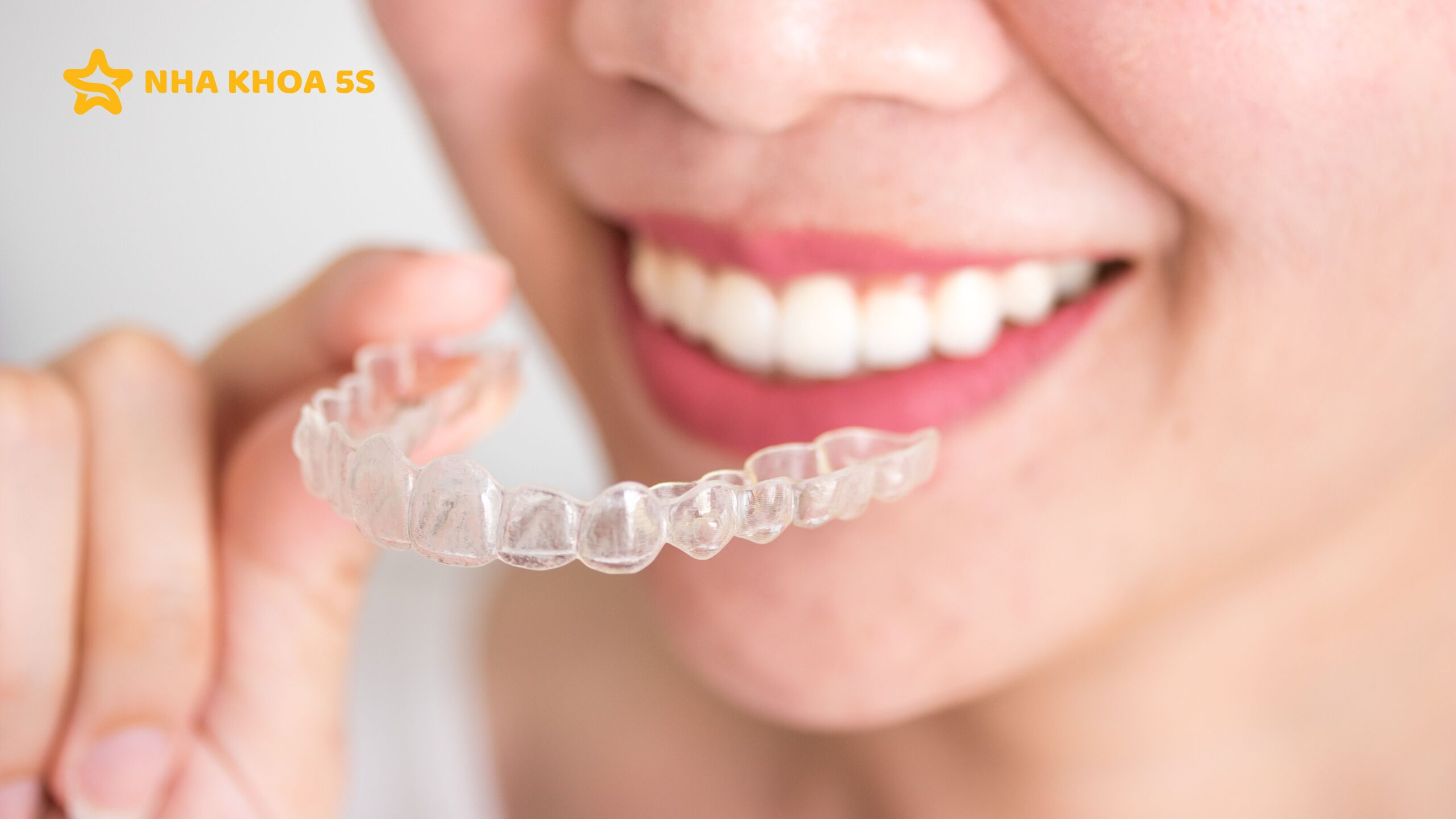 NIỀNG RĂNG TRẢ GÓP: GIẢI PHÁP TÀI CHÍNH LINH HOẠT