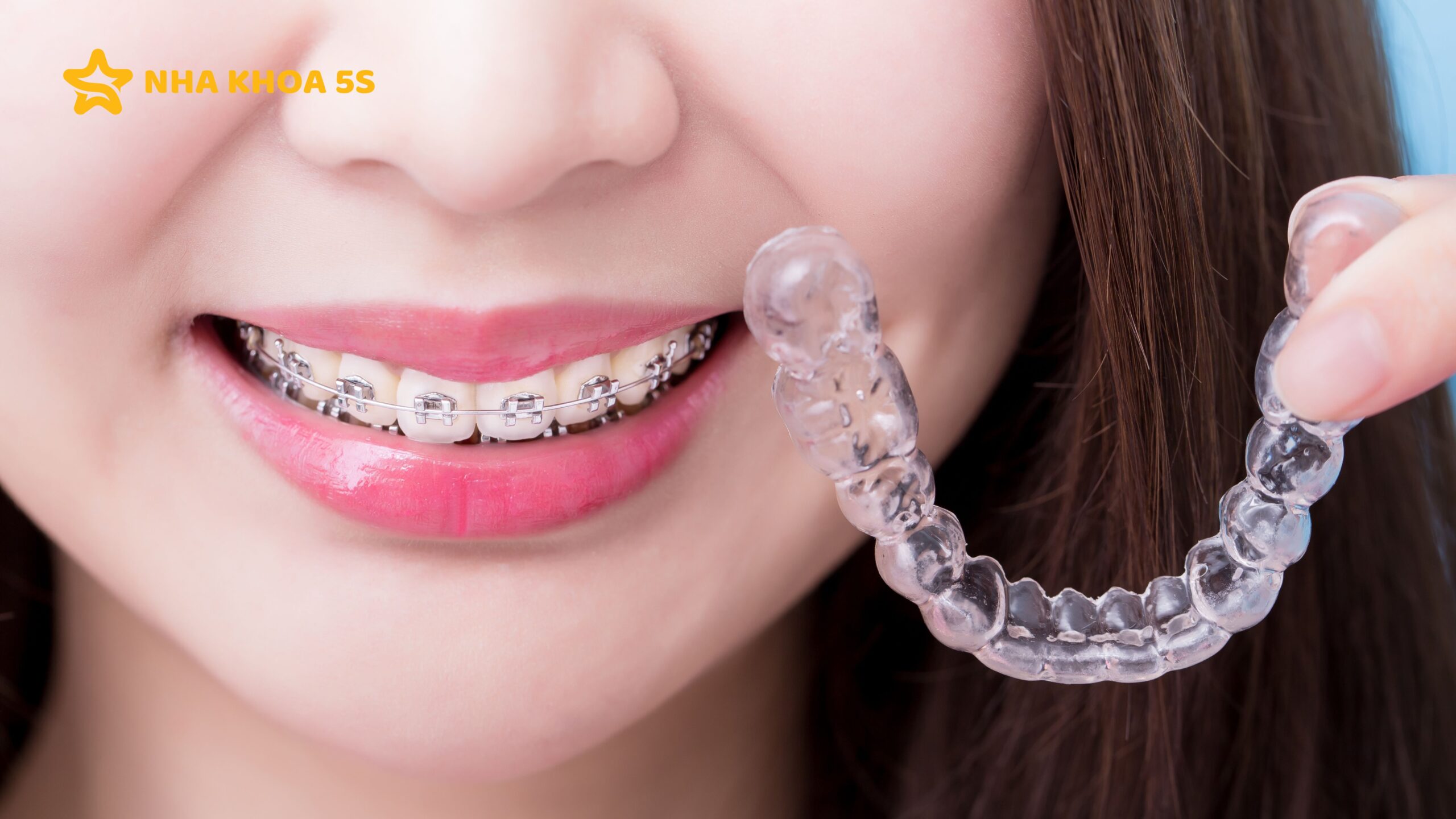 NIỀNG RĂNG 0% LÃI SUẤT: GIẢI PHÁP TÀI CHÍNH HOÀN HẢO GIÚP BẠN TỰ TIN TOẢ SÁNG