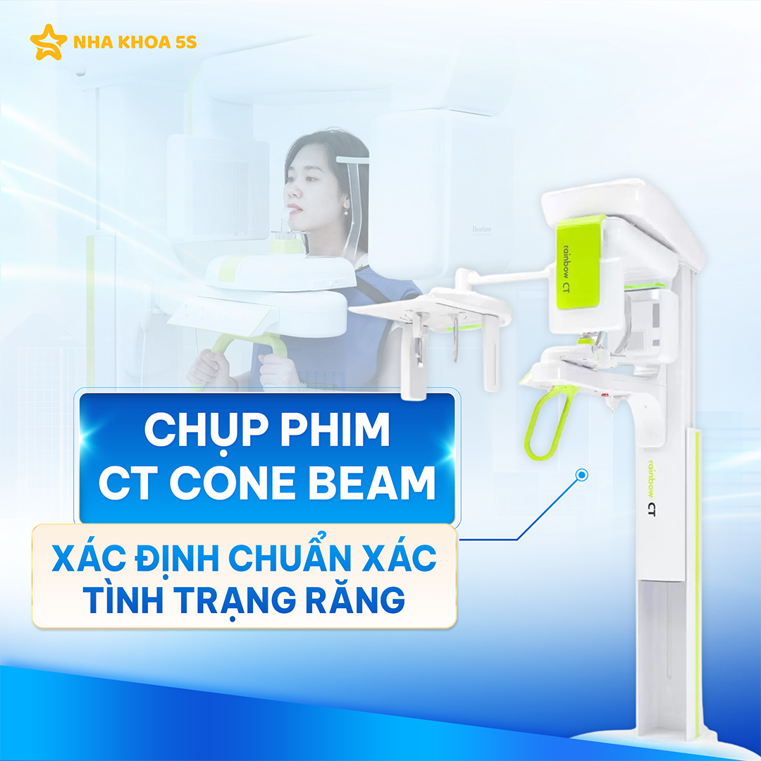 GIÁ IMPLANT MỸ THO: VÌ SAO NÊN CHỌN ĐẦU TƯ CHO NỤ CƯỜI BỀN VỮNG?