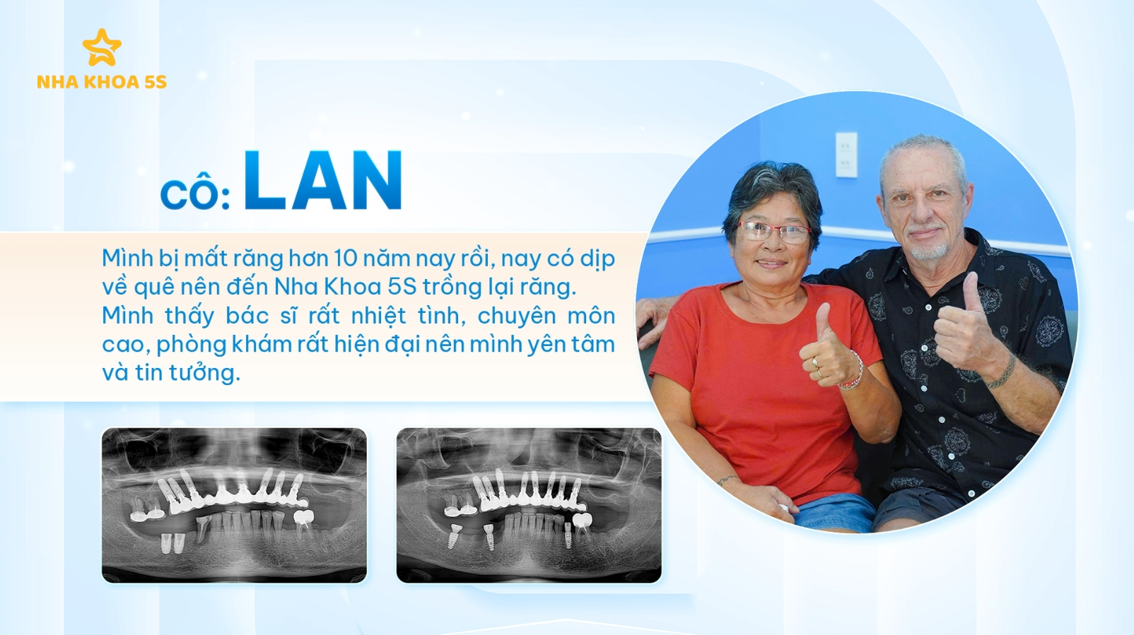 GIÁ IMPLANT MỸ THO: VÌ SAO NÊN CHỌN ĐẦU TƯ CHO NỤ CƯỜI BỀN VỮNG?
