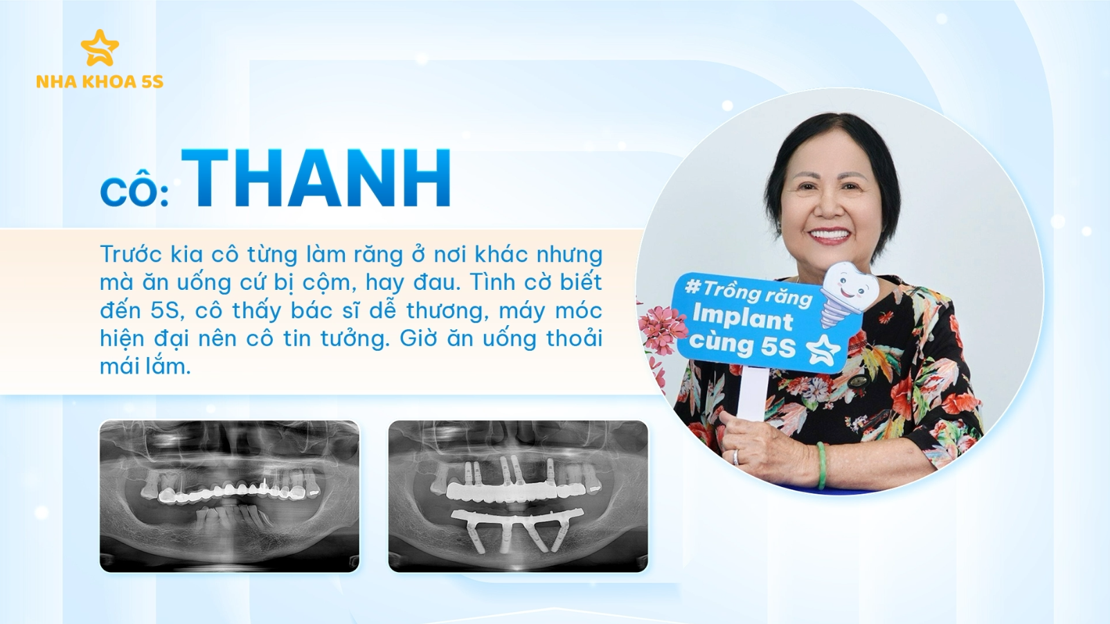 CẤY GHÉP IMPLANT MỸ THO - TRẢI NGHIỆM THỰC TẾ TỪ KHÁCH HÀNG 5S CẤY GHÉP IMPLANT MỸ THO – TRẢI NGHIỆM THỰC TẾ TỪ KHÁCH HÀNG 5S