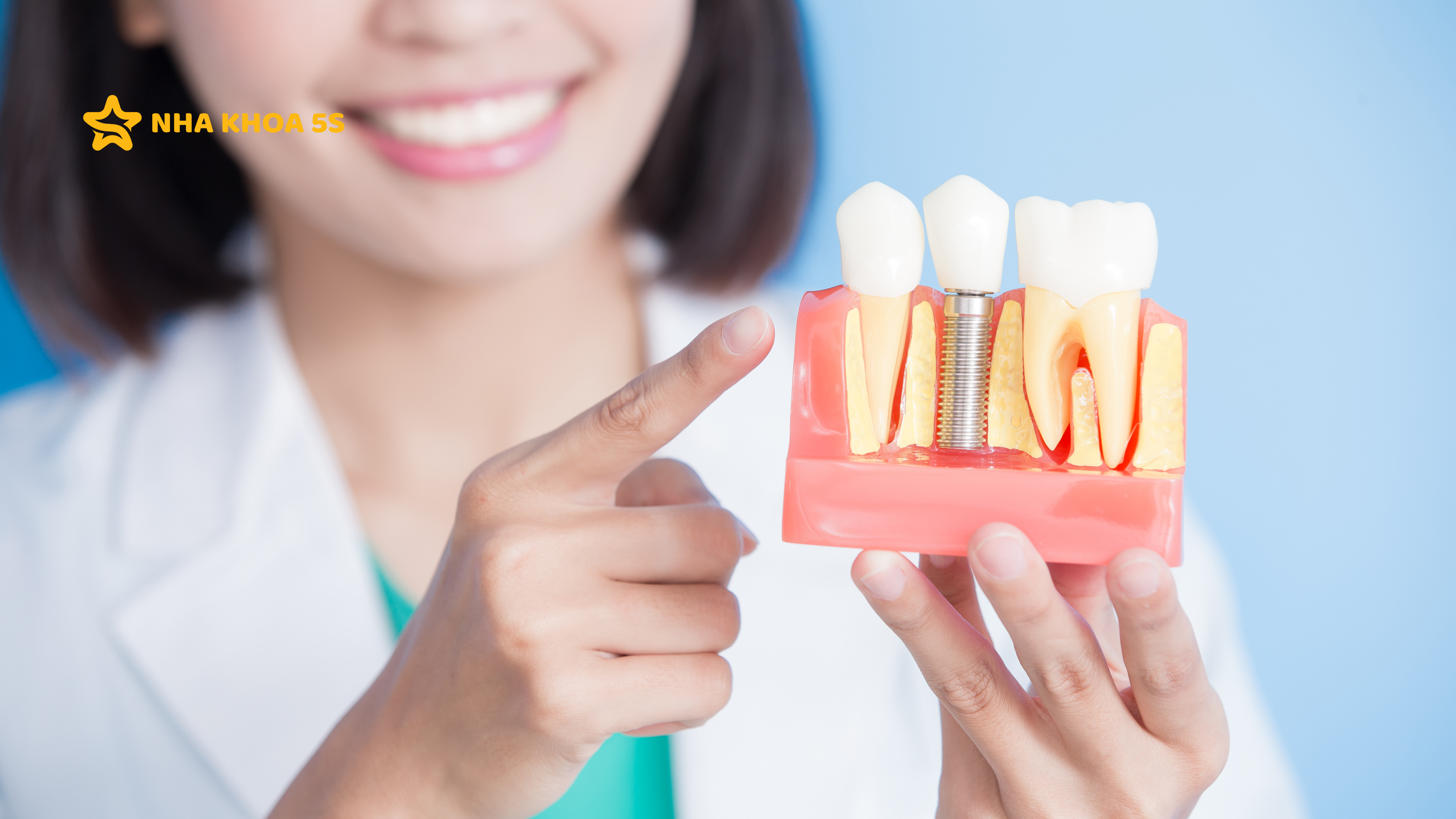 CẤY GHÉP IMPLANT MỸ THO – TRẢI NGHIỆM THỰC TẾ TỪ KHÁCH HÀNG 5S