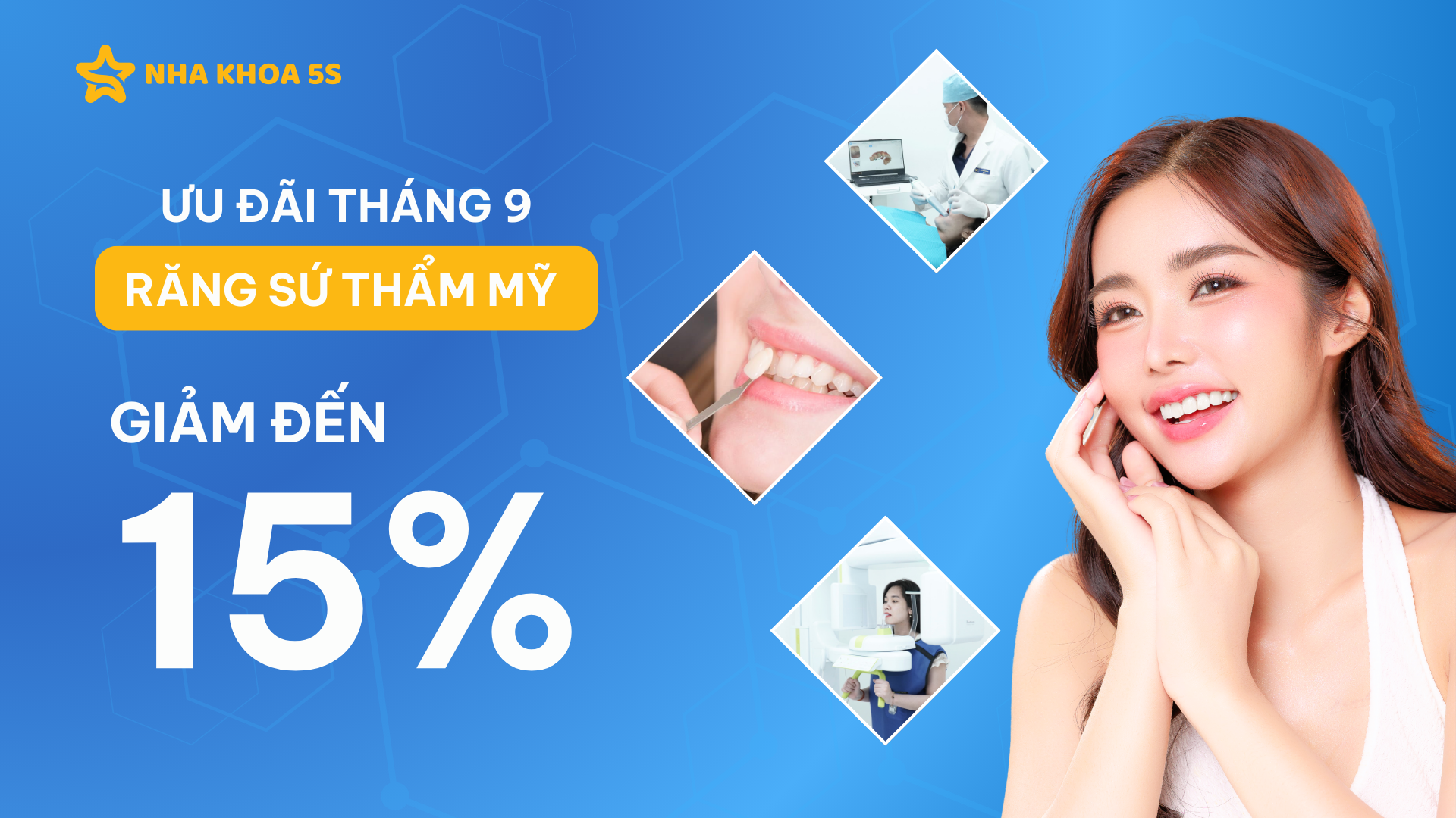 Ưu Đãi Răng Sứ – Cơ Hội Vàng Nâng Tầm Nụ Cười Tại Nha Khoa 5S Ưu Đãi Răng Sứ – Cơ Hội Vàng Nâng Tầm Nụ Cười Tại Nha Khoa 5S