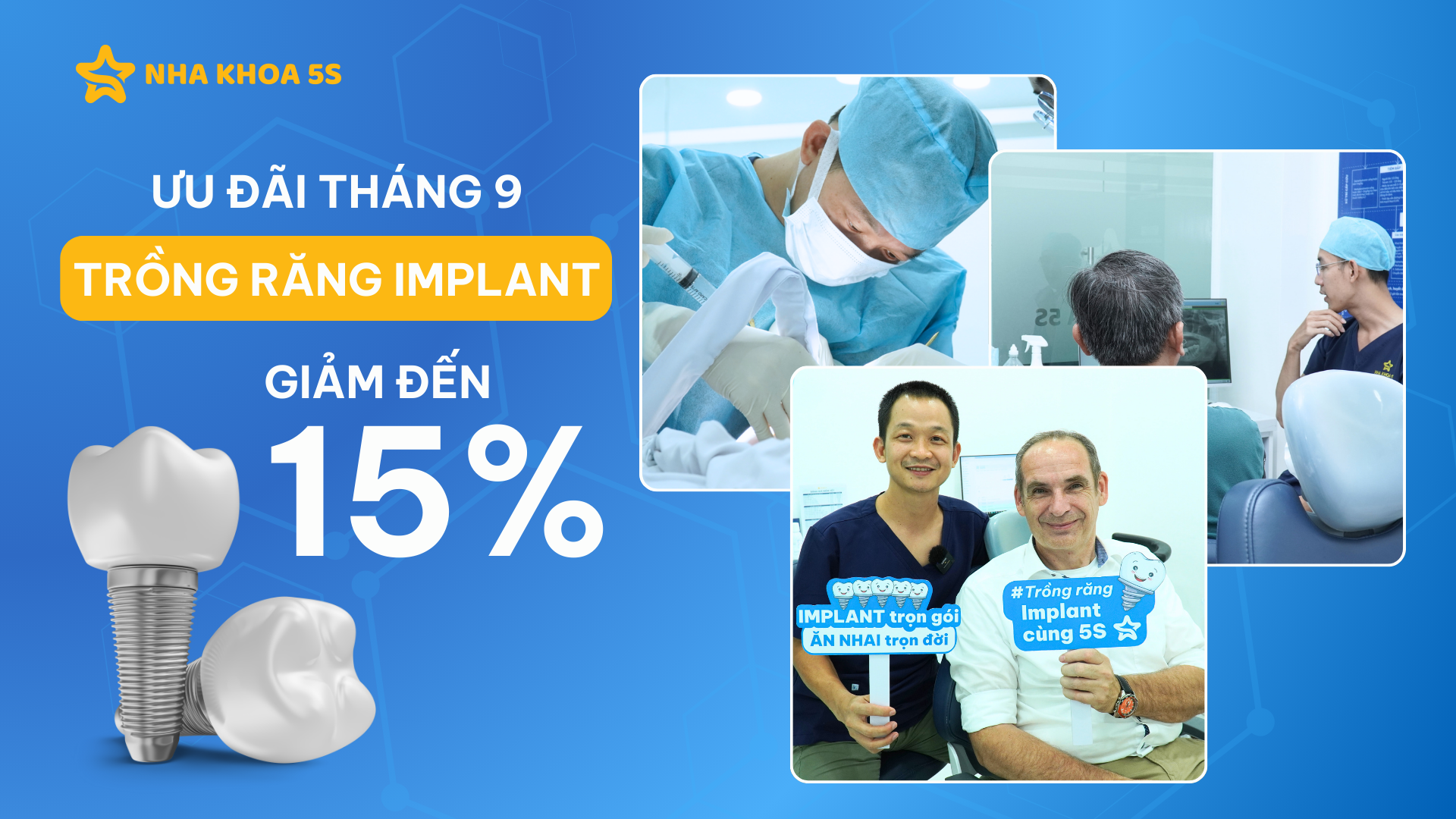 ƯU ĐÃI TRỒNG RĂNG IMPLANT GIẢM ĐẾN 15% – CƠ HỘI HOÀN TIỀN ĐẾN 100%