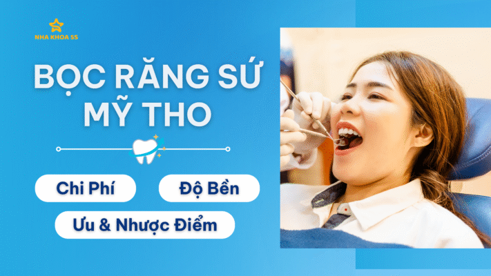 boc-rang-su-my-tho-thumb