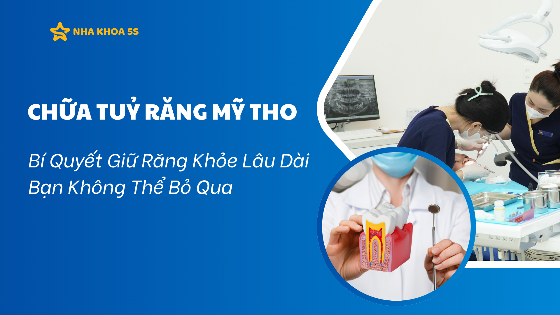 CHỮA TỦY RĂNG MỸ THO: BÍ QUYẾT GIỮ RĂNG KHỎE LÂU DÀI BẠN KHÔNG THỂ BỎ QUA