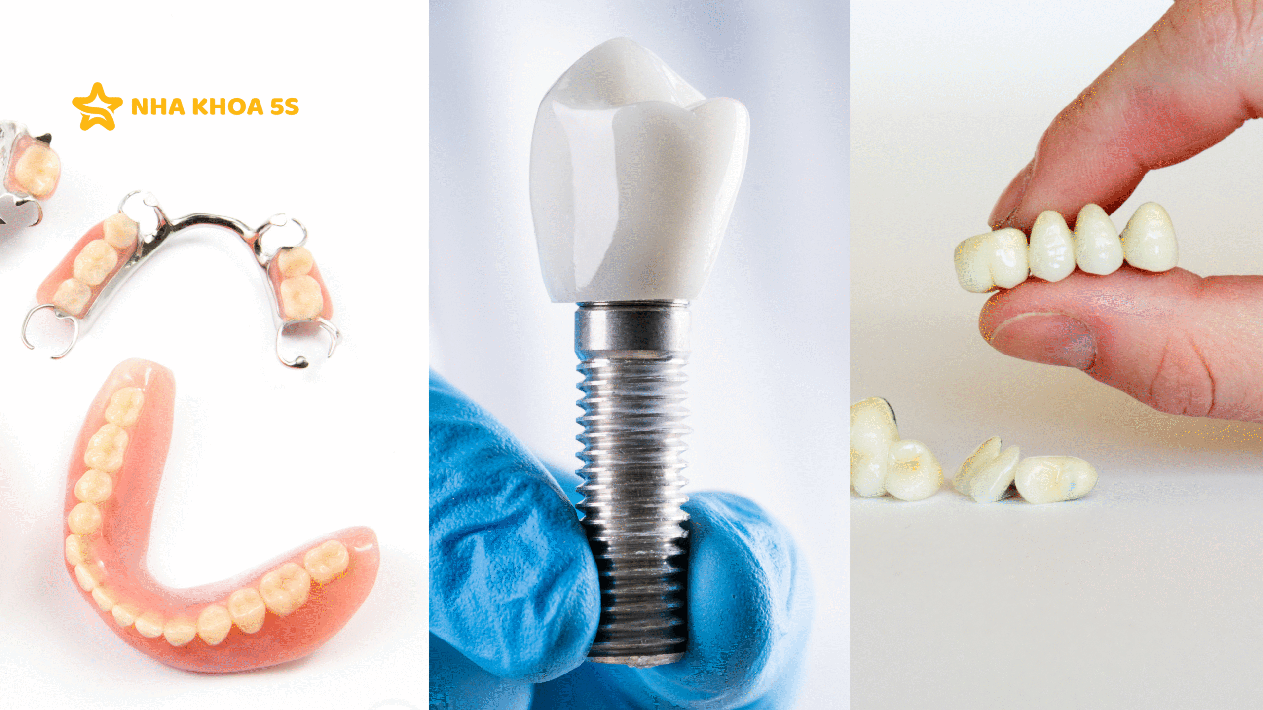 CẤY GHÉP IMPLANT MỸ THO - TRẢI NGHIỆM THỰC TẾ TỪ KHÁCH HÀNG 5S CẤY GHÉP IMPLANT MỸ THO – TRẢI NGHIỆM THỰC TẾ TỪ KHÁCH HÀNG 5S