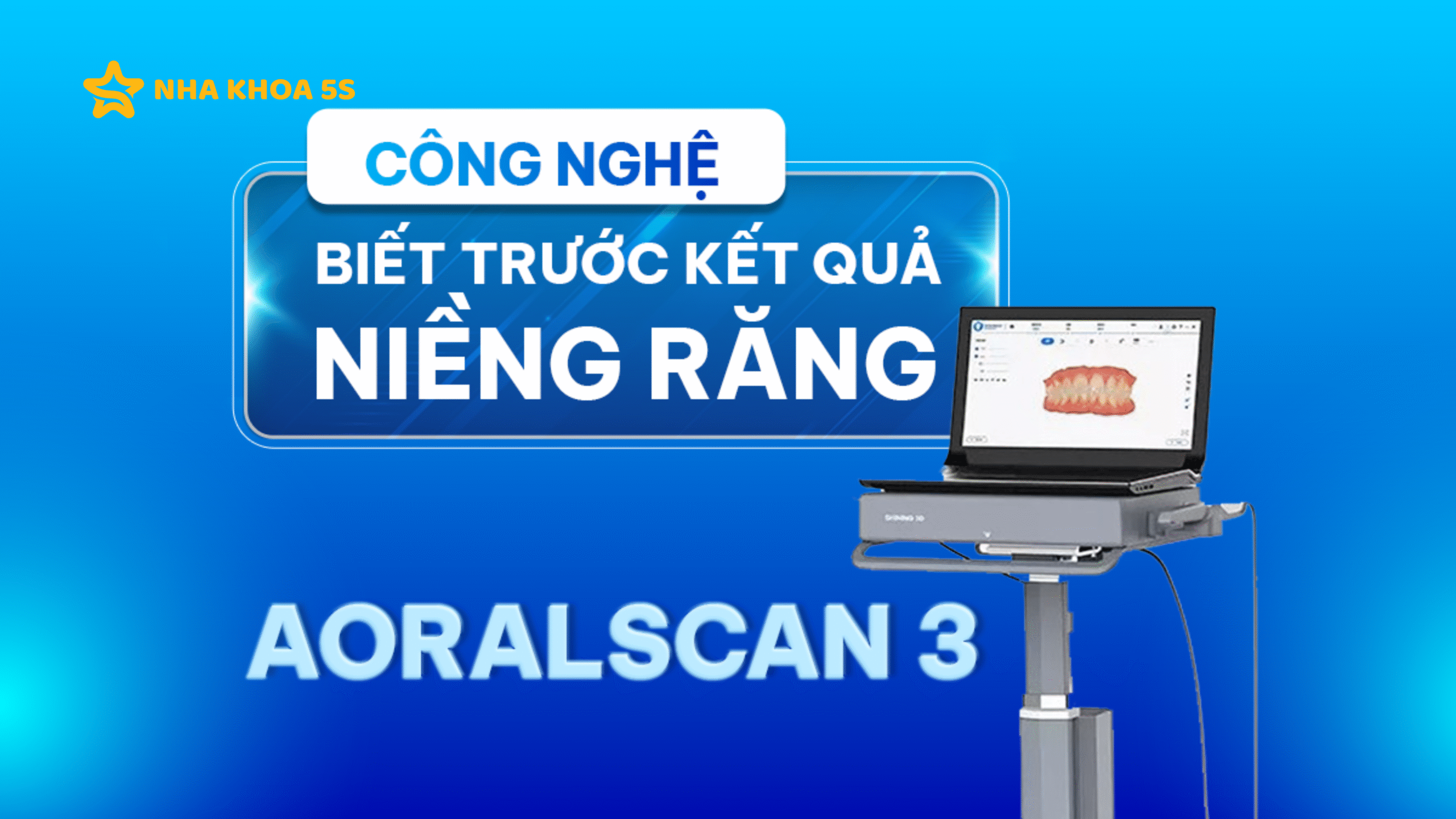 NIỀNG RĂNG MẮC CÀI MỸ THO: PHÂN LOẠI, ƯU – NHƯỢC ĐIỂM CẦN BIẾT