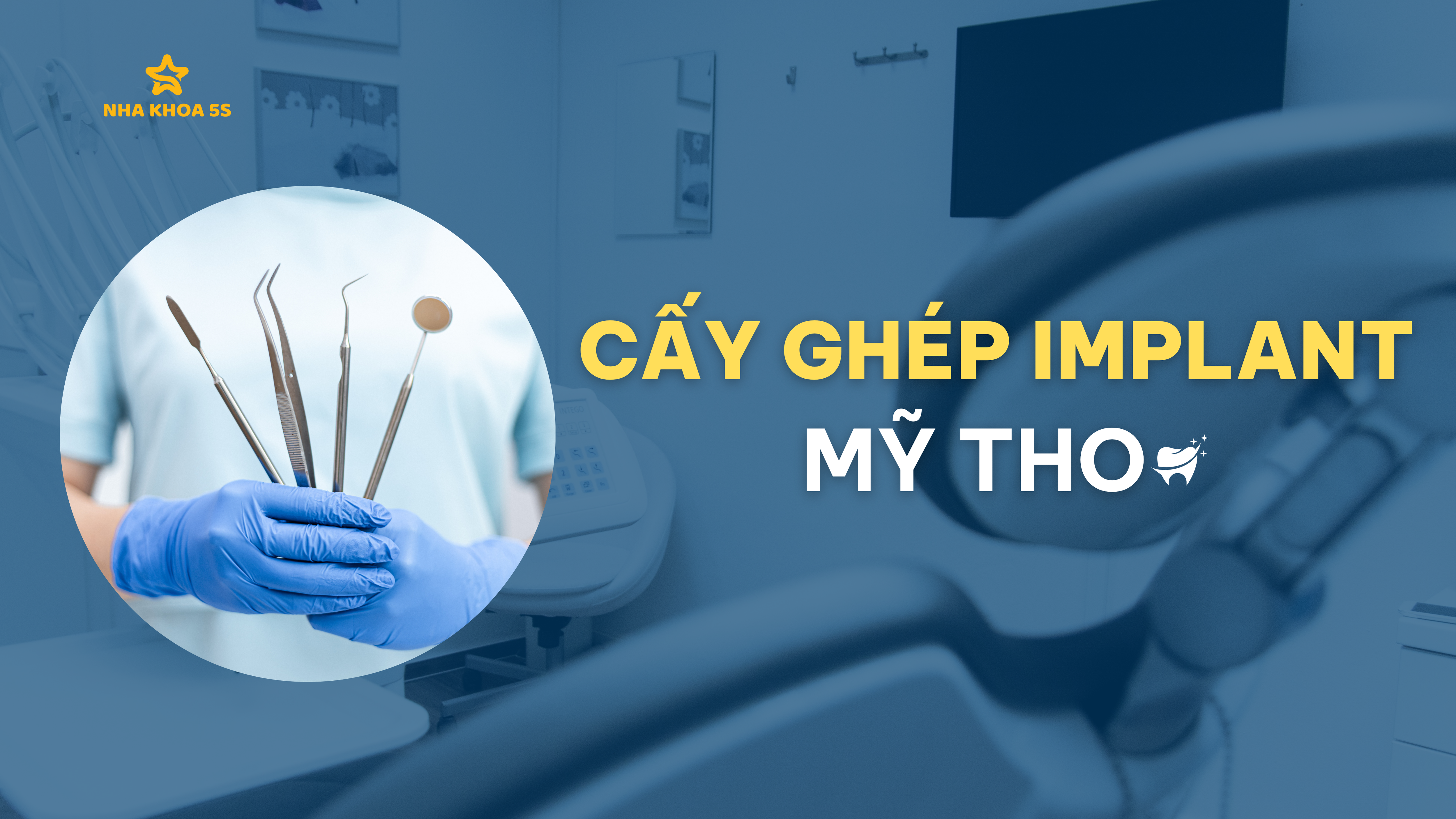 cay-ghep-implant-my-tho-thumb