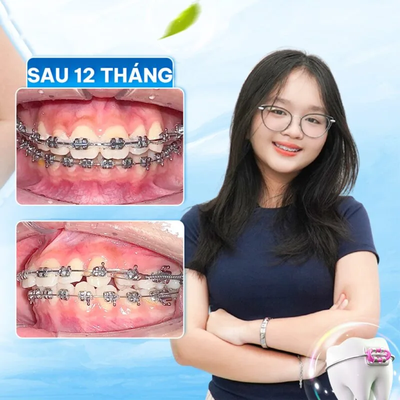 534815577 669211129554568 8659224292722898804 N 24