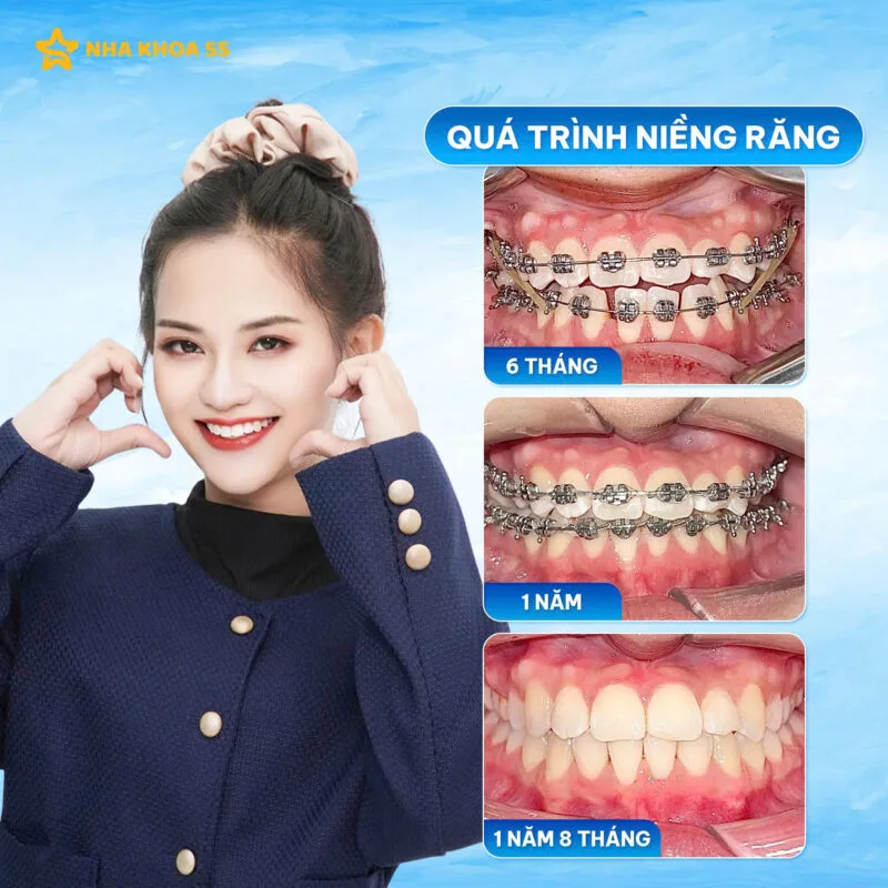 560562583 716350738173940 2771534451742118850 N 24