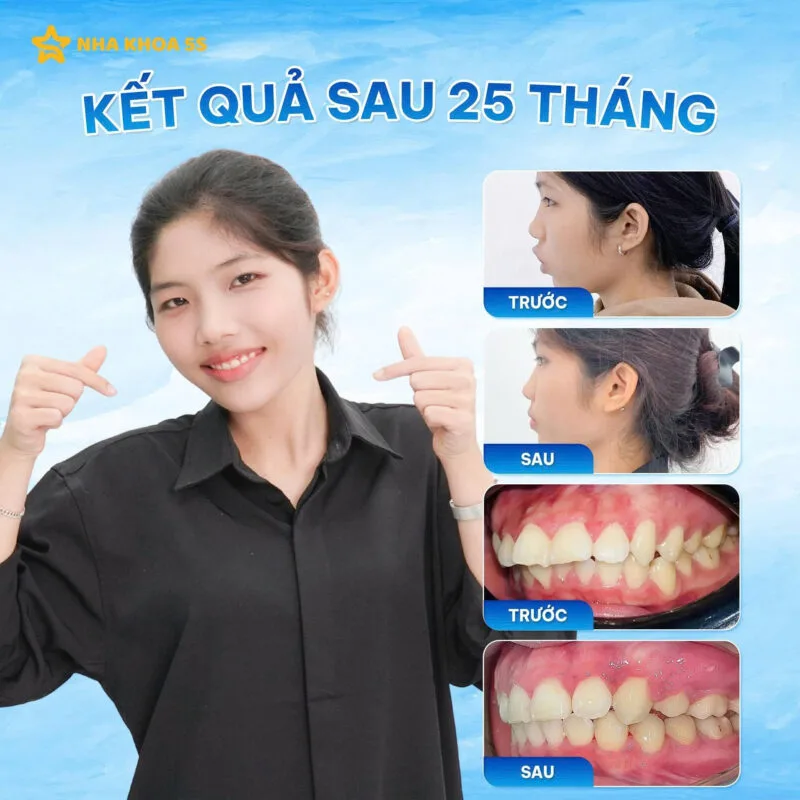 586182206 750163611459319 6668484366572335054 N 24