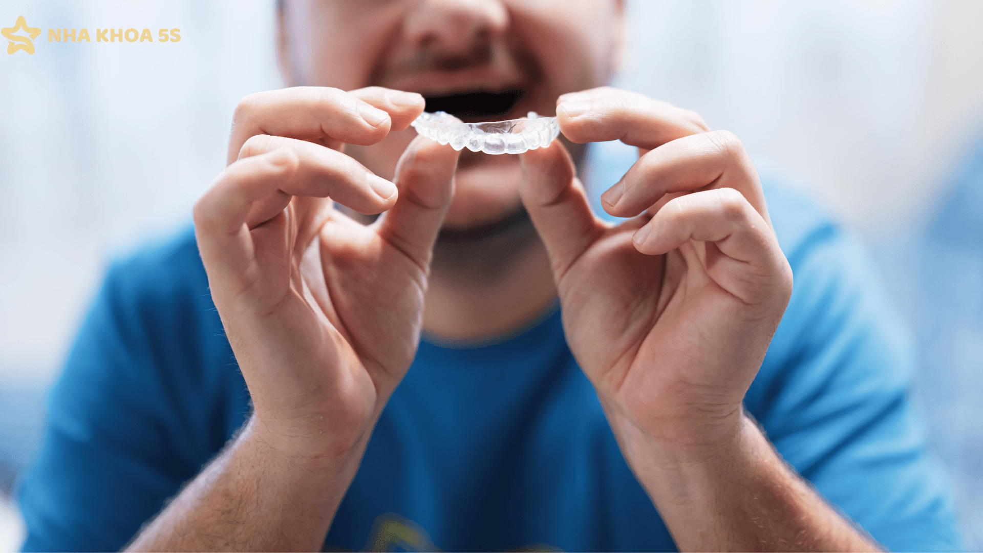 Niềng Invisalign Cho Răng Hô: Giải Pháp Chỉnh Nha Thẩm Mỹ, Kín Đáo Và Hiệu Quả Lâu Dài