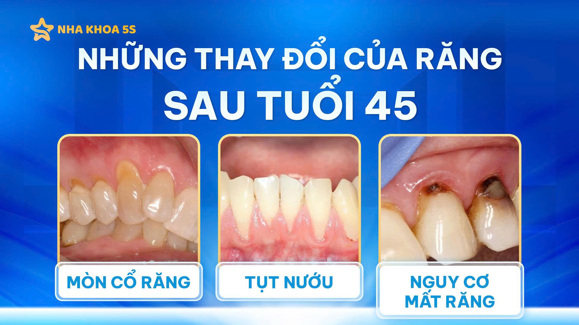 Ưu Đãi Dành Cho Khách Hàng Trên 45 Tuổi – Miễn Phí Thăm Khám, Giảm Đến 50%