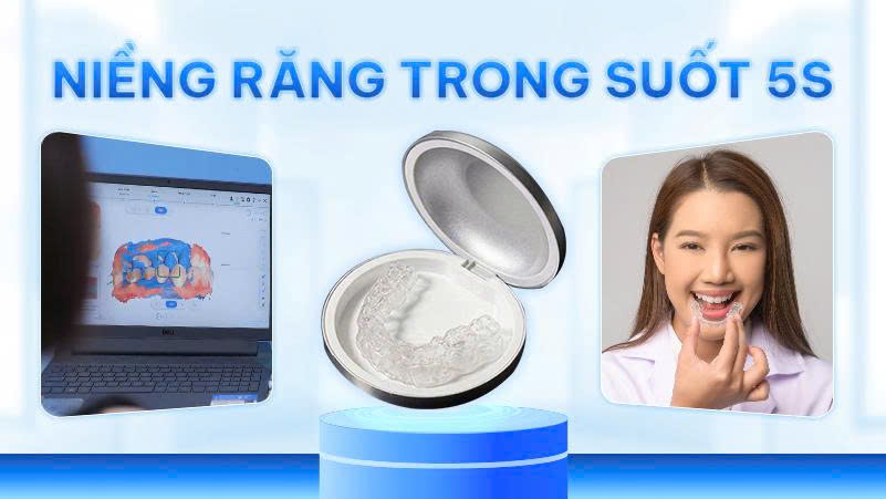 Ra Mắt Dịch Vụ Niềng Răng Trong Suốt 5S