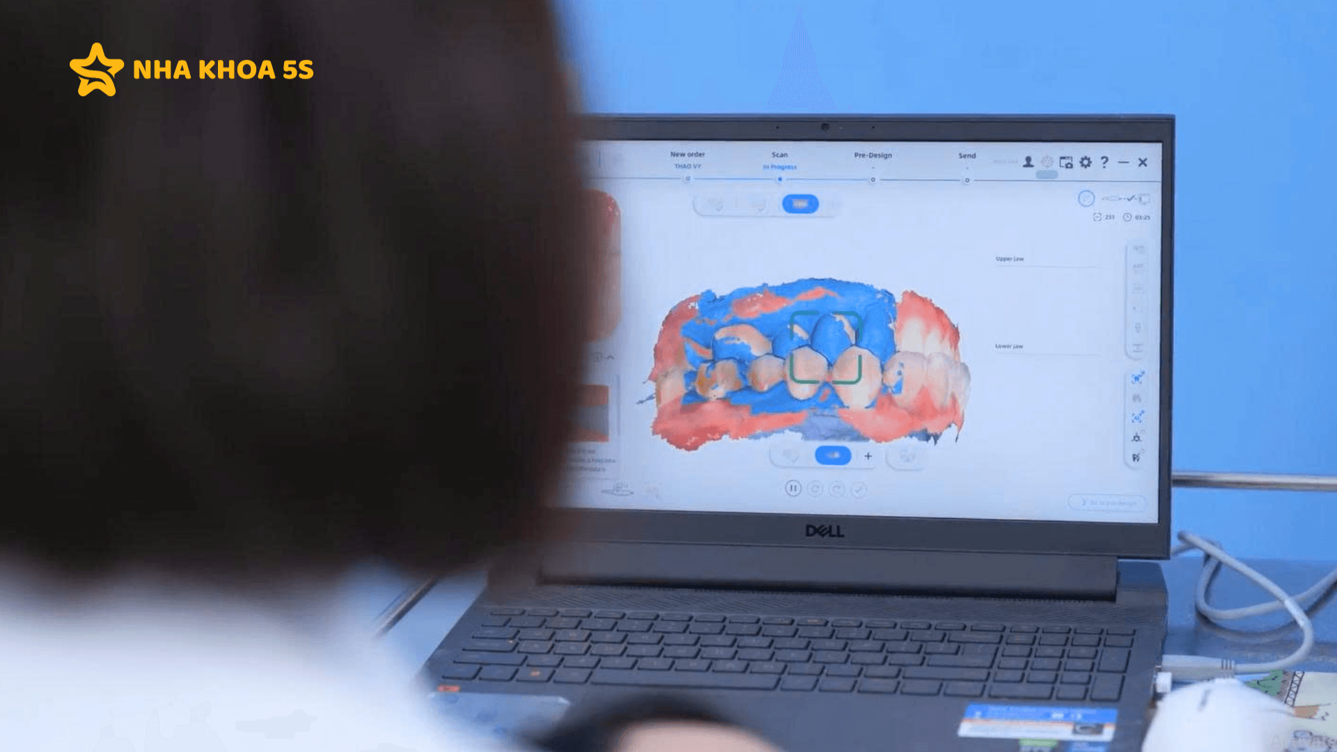 Nha Khoa Niềng Răng Uy Tín &Amp;#8211; Lựa Chọn Quan Trọng Quyết Định Kết Quả Điều Trị