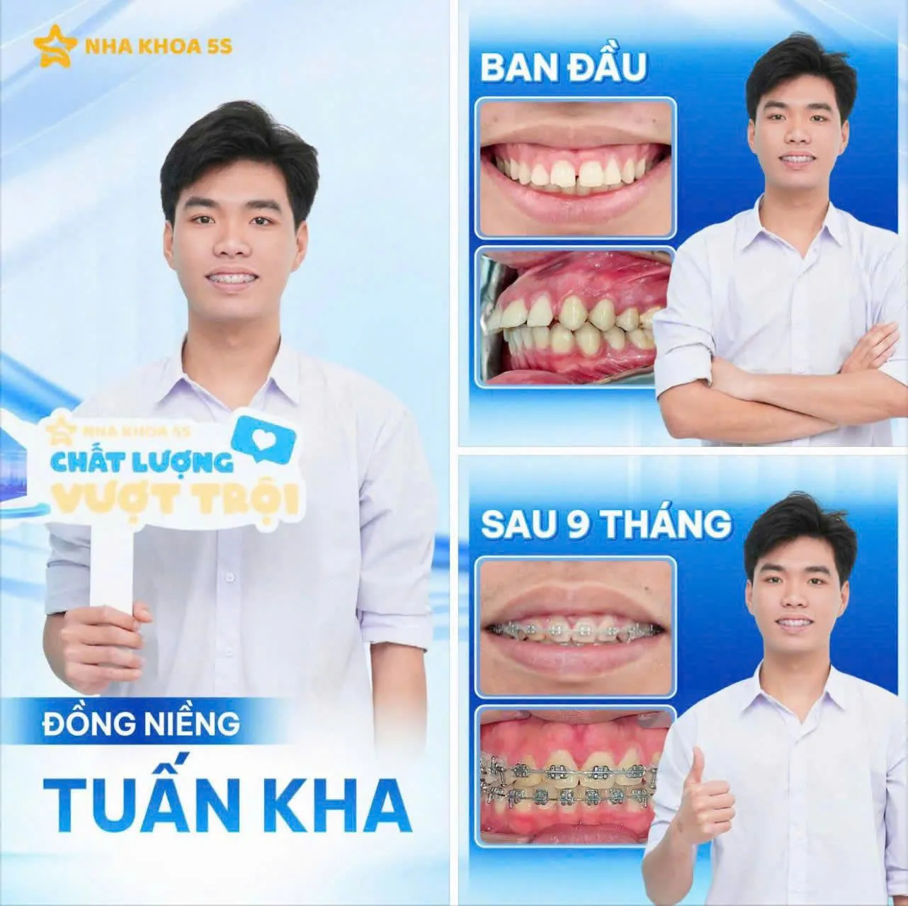 Khách Hàng Niềng Răng 1