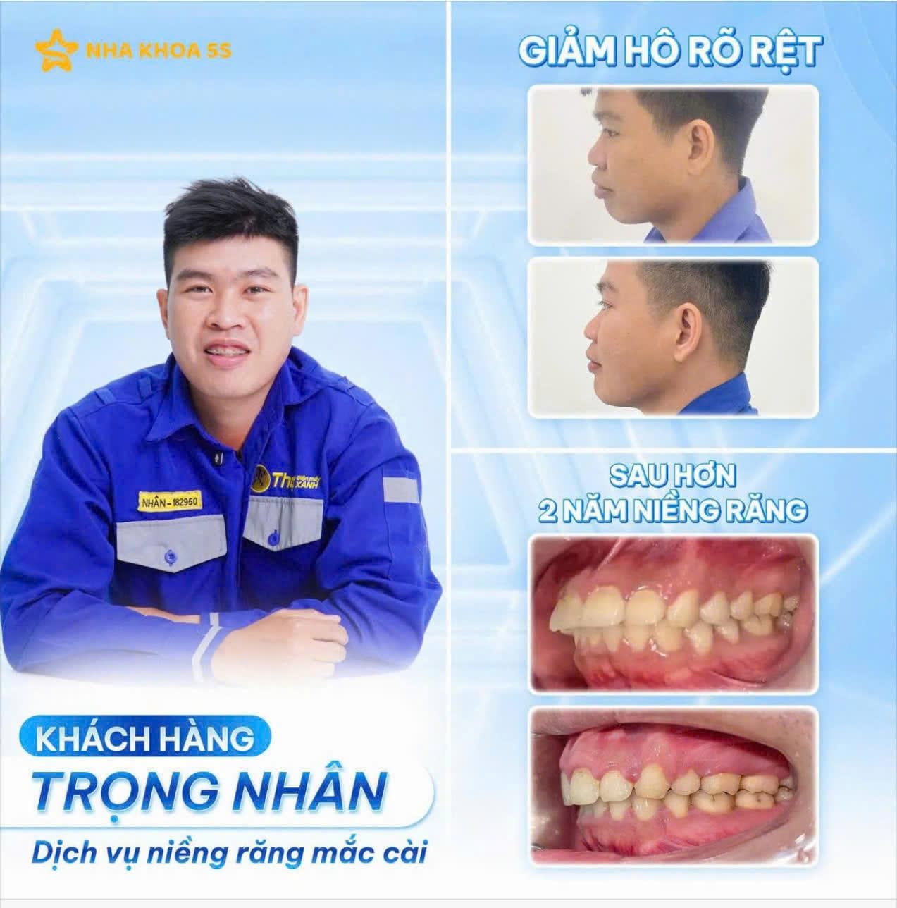 Khách Hàng Niềng Răng 2