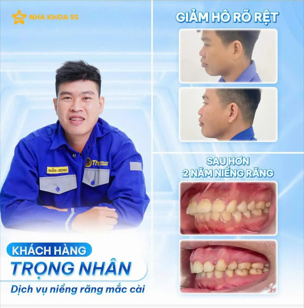 Khách Hàng Niềng Răng 2