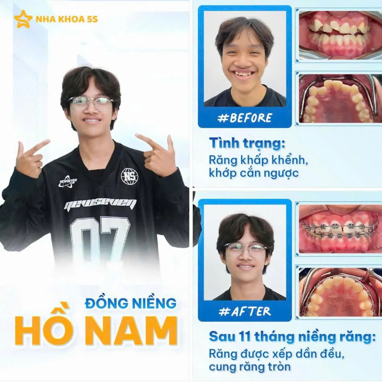 Khách Hàng Niềng Răng 7