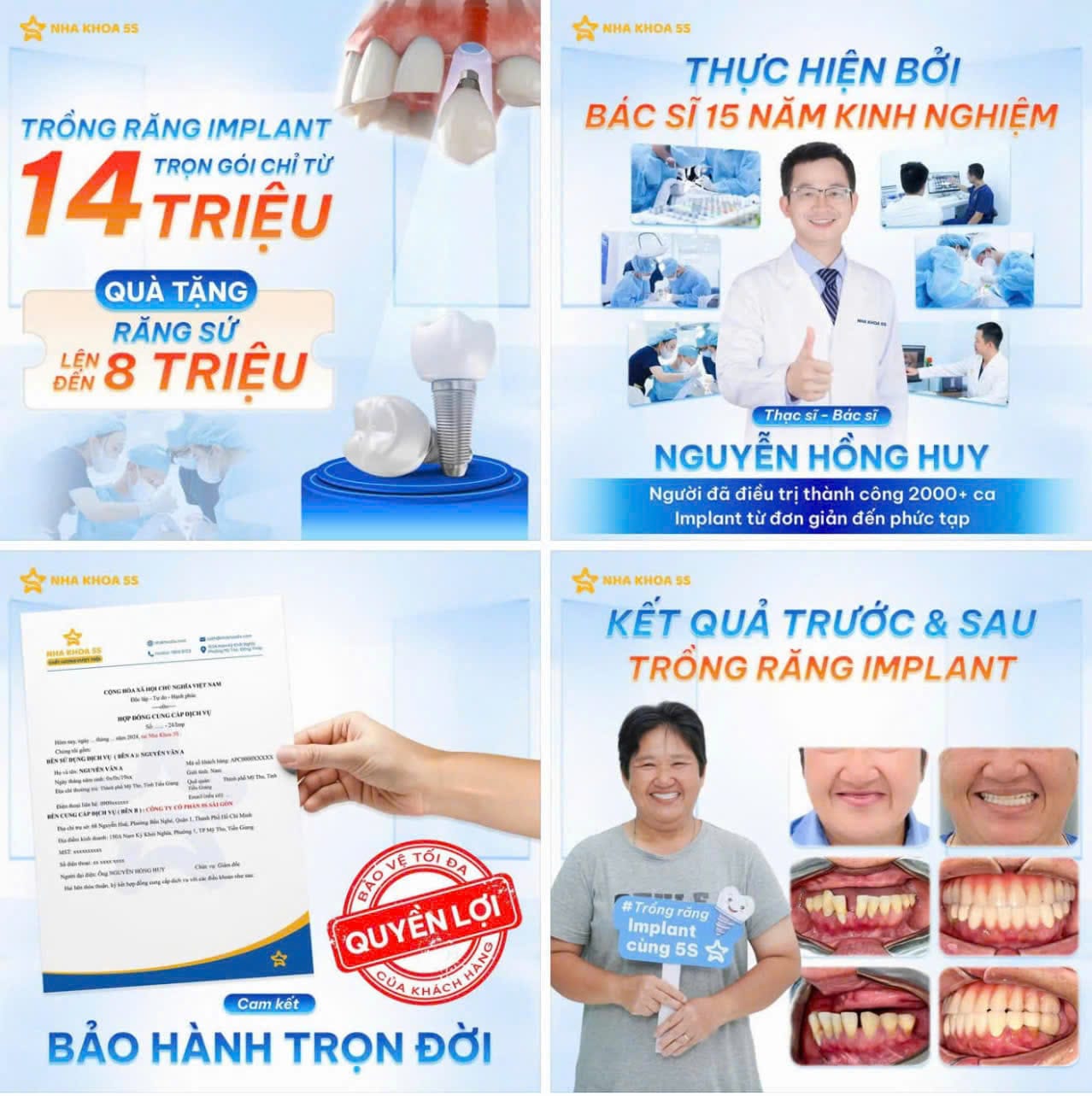 Bảng Giá Trồng Răng Implant 5S Toàn Hàm Tại Nha Khoa 5S